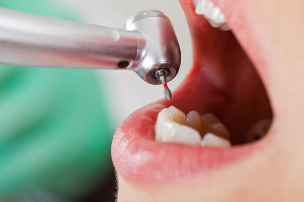 Best Emergency Orthodontic Repairs in East Moline, IL